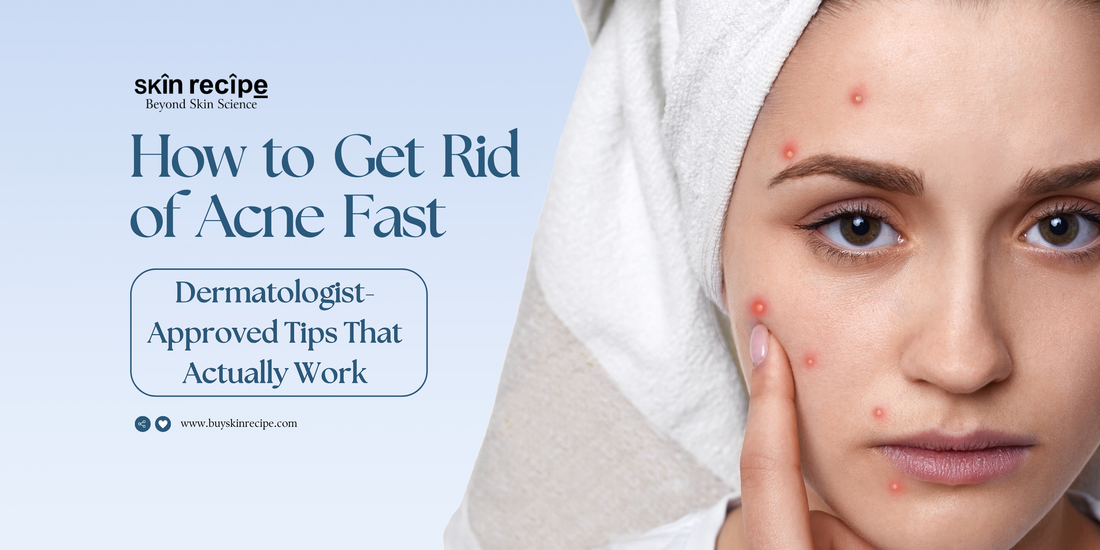 How to Get Rid of Acne Fast — Dermatologist-Approved Tips That Actually Work