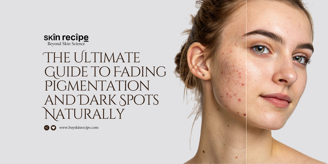 The Ultimate Guide to Fading Pigmentation and Dark Spots Naturally