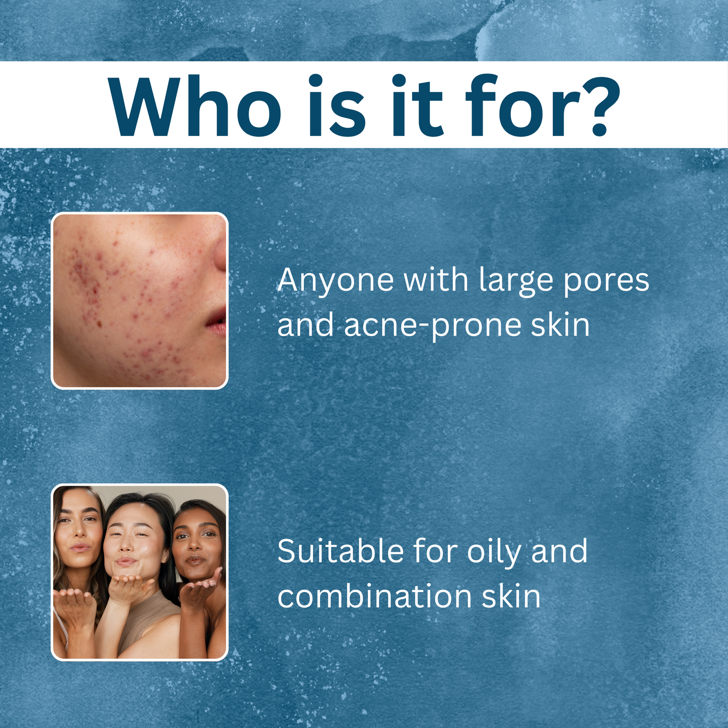 Combination Skin Balance Kit