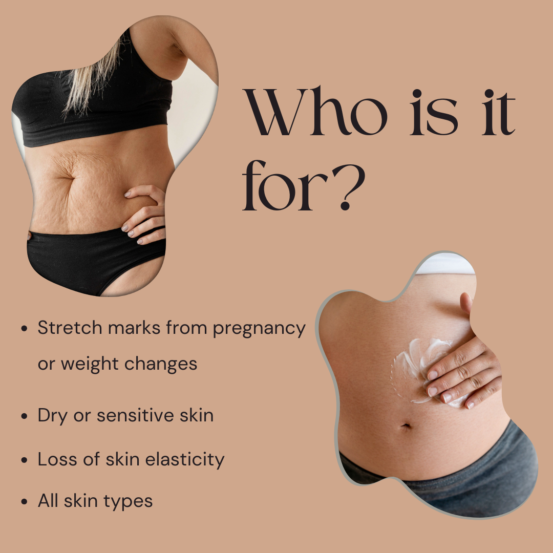 Stretch Marks Oil