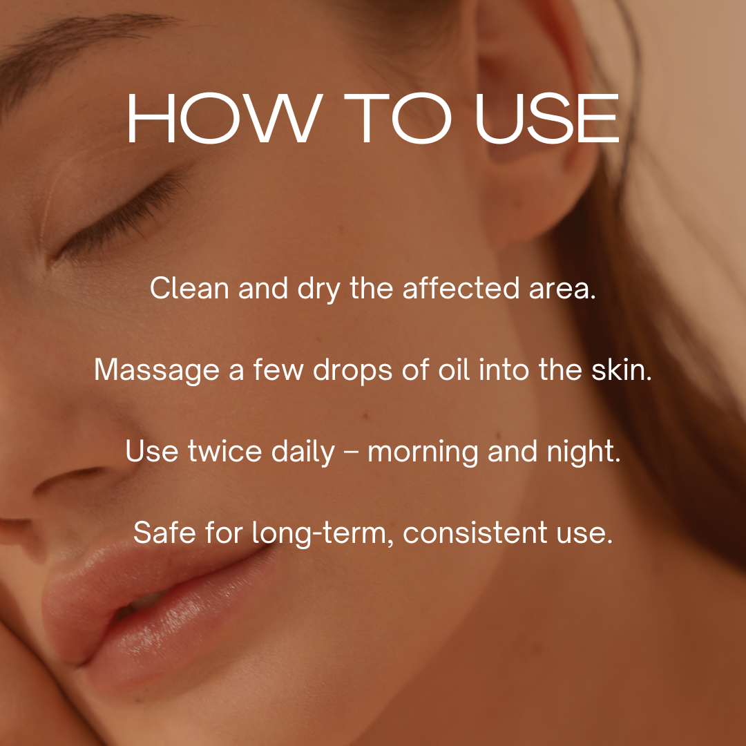 Stretch Marks Oil