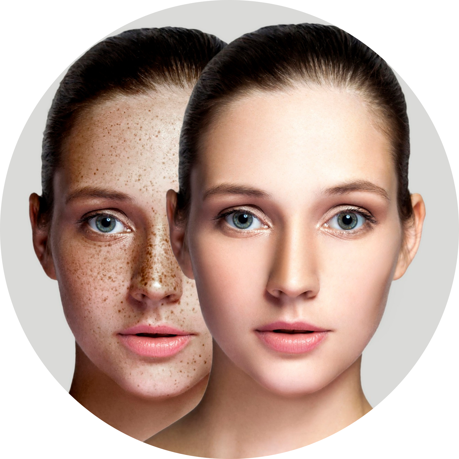 Pigmentation